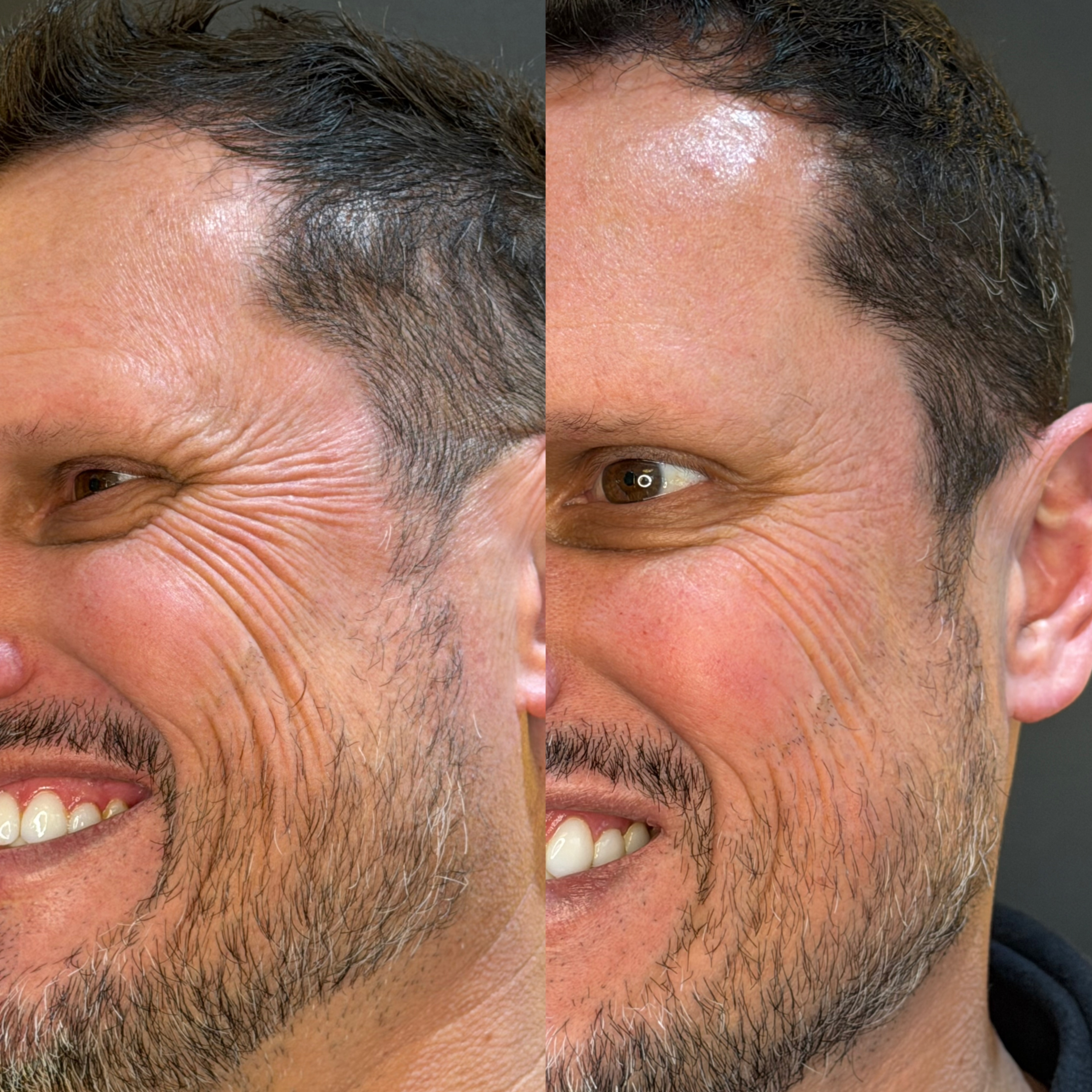 Resultado